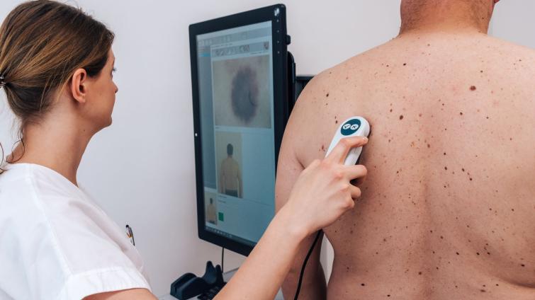 Den melanomu nabídne preventivní vyšetření kůže zdarma a bez objednání