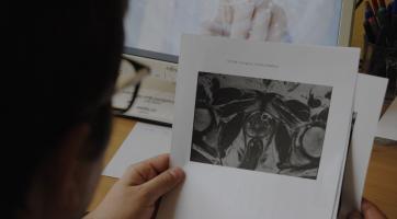 Kroměřížská urologie se zapojí do pilotního programu k detekci rakoviny prostaty