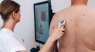 Den melanomu nabídne preventivní vyšetření kůže zdarma a bez objednání