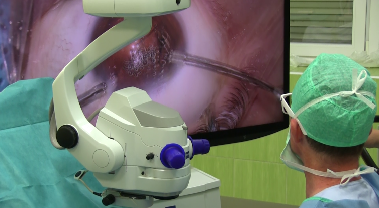 Nový mikrochirurgický přístroj na operace očí pořídila kyjovská nemocnice jako první v ČR