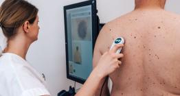 Den melanomu nabídne preventivní vyšetření kůže zdarma a bez objednání