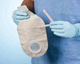 Život s umělým vývodem není tabu. Baťova nemocnice chystá edukační setkávání se stomiky