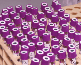 Nová hematologická linka zanalyzuje až 450 vzorků denně