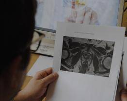 Kroměřížská urologie se zapojí do pilotního programu k detekci rakoviny prostaty
