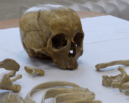 Na základní škole v Uherském Hradišti sloužila jako učební pomůcka pravá lidská kostra