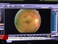 Nemocnice v Kyjově nabízí novou léčbu očních chorob