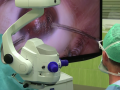 Nový mikrochirurgický přístroj na operace očí pořídila kyjovská nemocnice jako první v ČR